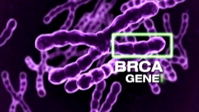 Should Women With The BRCA Gene Remove Their Ovaries a New Study May Change The Way We Think