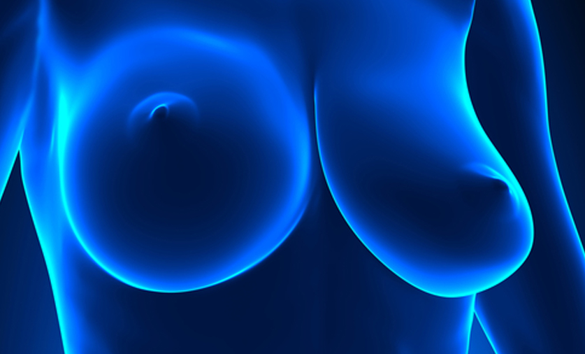 uneven breasts