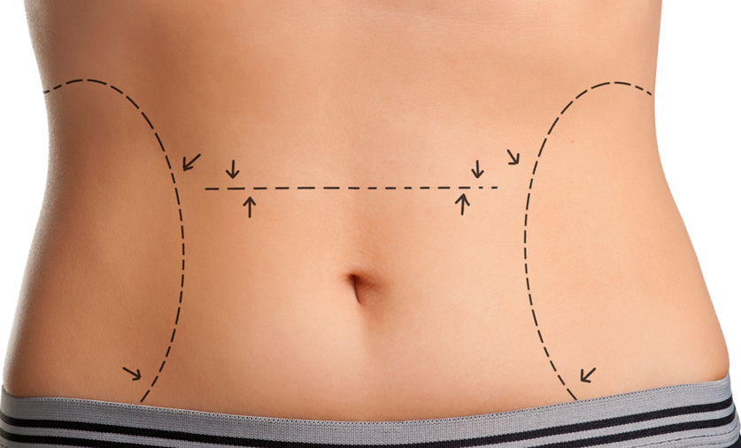 spine Repeated Centralize Body Contouring Surgery Myths Debunked in Westchester, Long Island & NYC