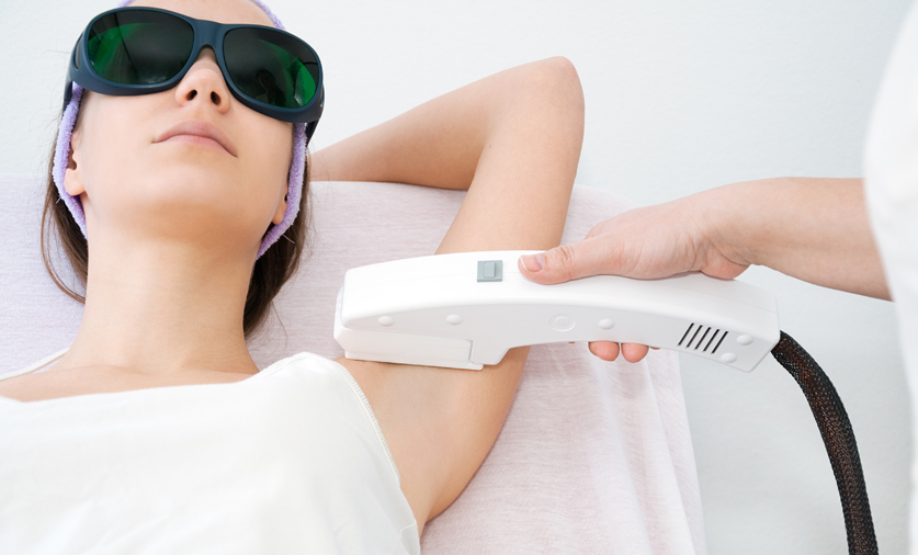 laser hair removal