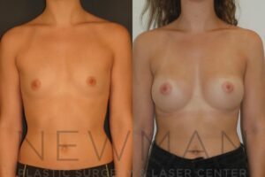 Case #7 before and after