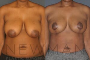 Case 132 before and after