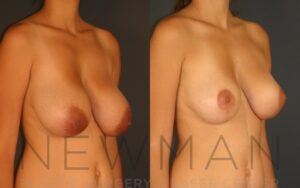 Case 27 before and after