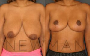 Case 28 before and after