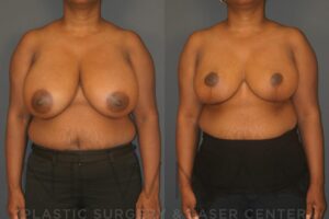 Case 29 before and after