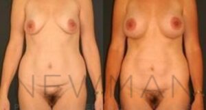 Case 36 before and after