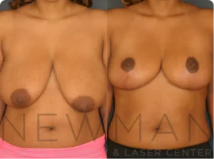 Case #28 before and after