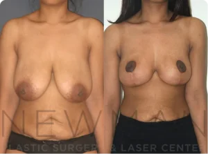 Case 147 before and after