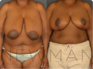 Case 145 before and after